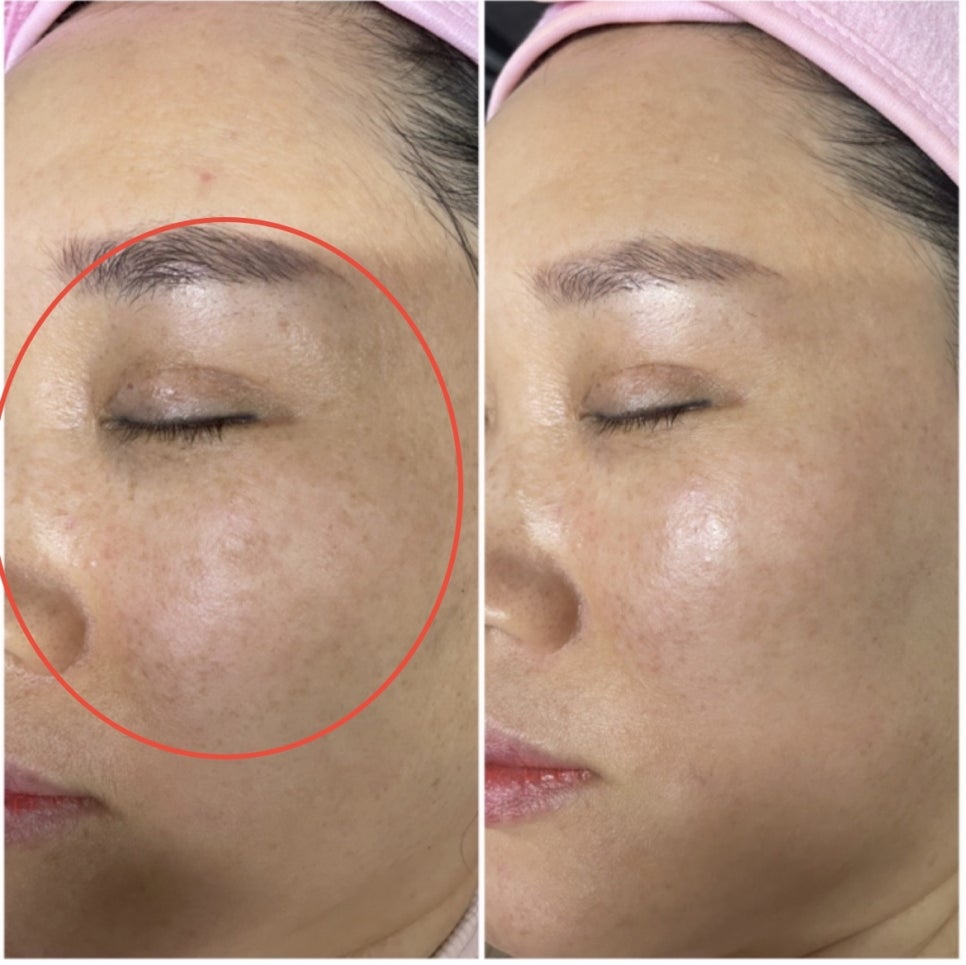 하얀피부샵 이미지
