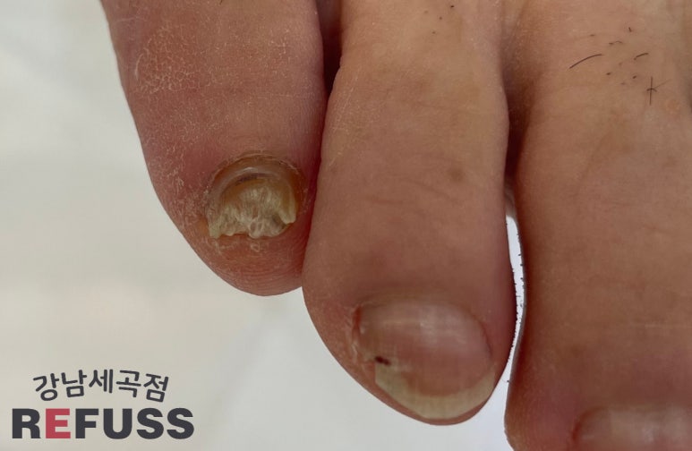 레푸스강남세곡점 이미지