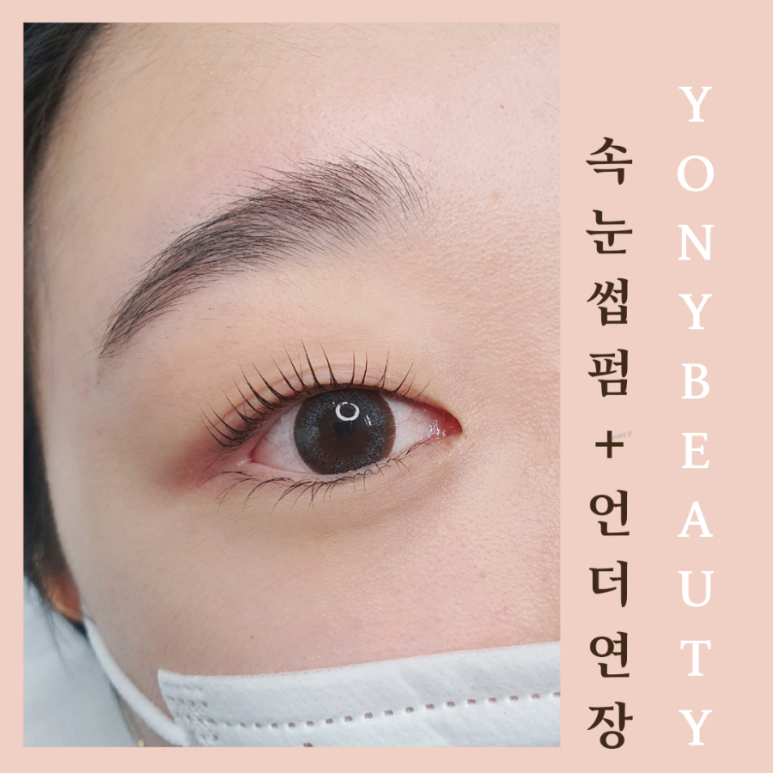 요니뷰티 이미지