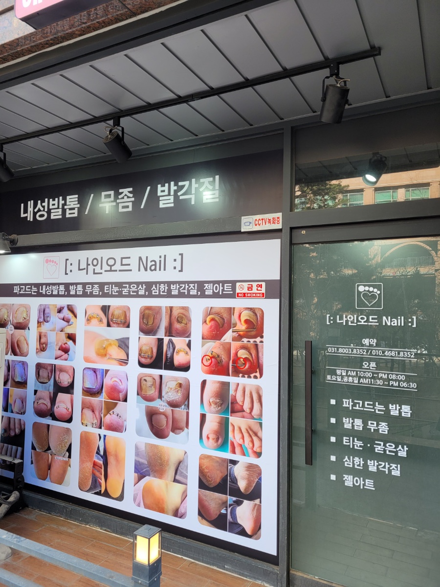 오드네일 이미지