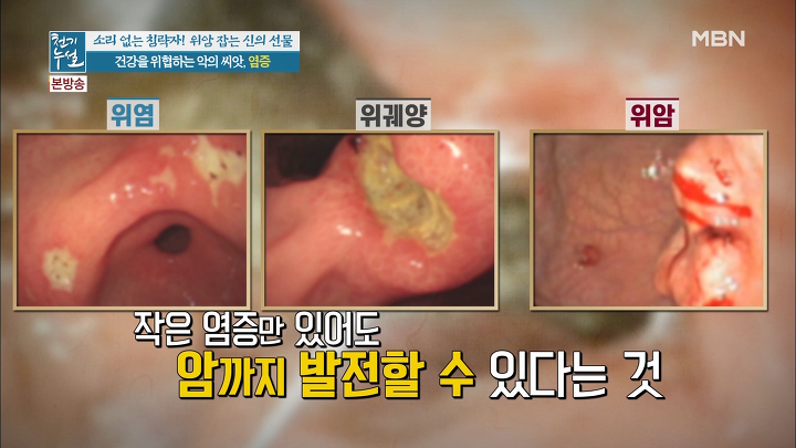 슈퍼바디짐 이미지