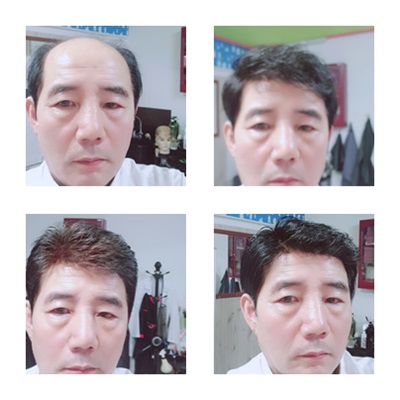에이모가발 이미지