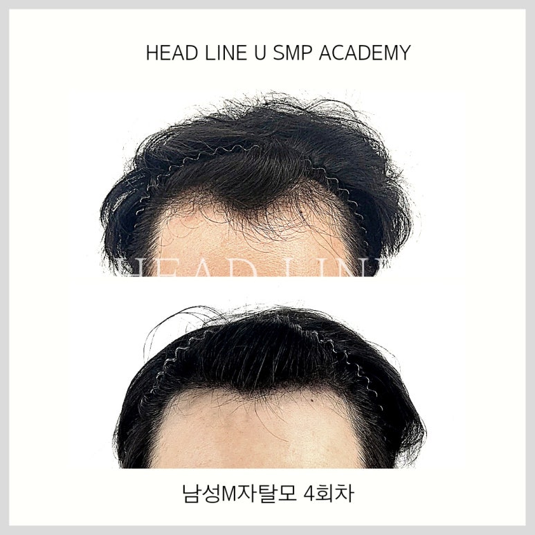 헤드라인유 이미지