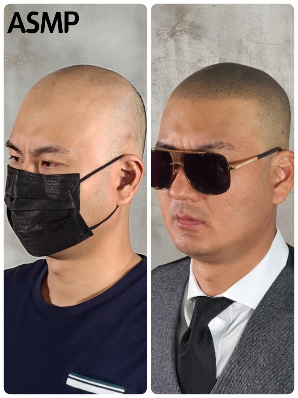 커버스토리뷰티스칼프 이미지