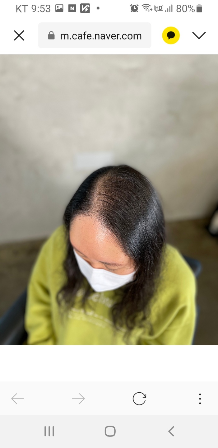 커버스토리뷰티스칼프 이미지