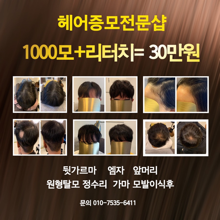 모발을 채우다 이미지