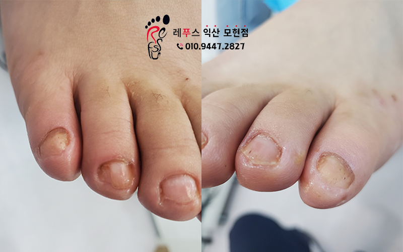 레푸스익산 이미지