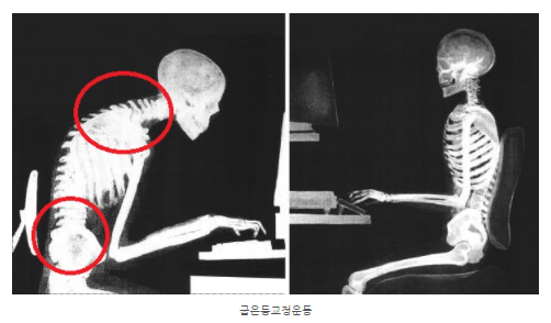 라벨짐 이미지