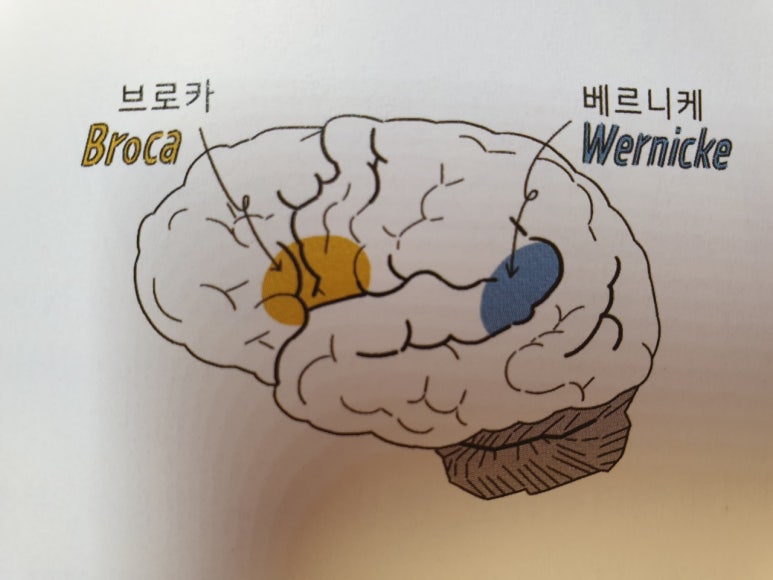 베르니케 이미지
