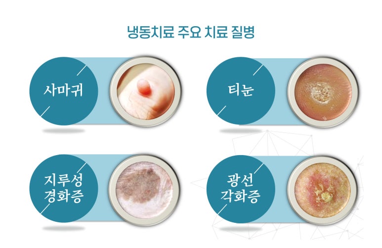 아주고운피부과 이미지