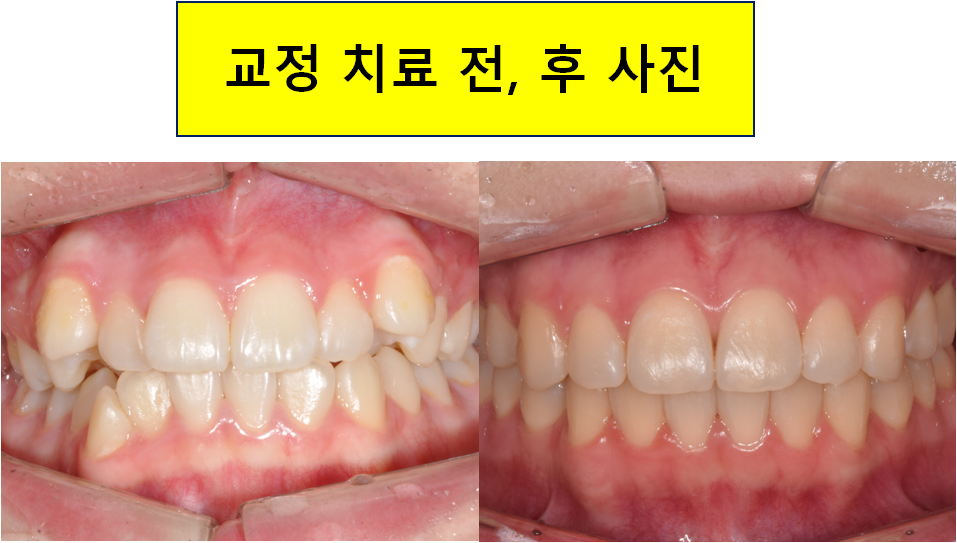 미아연세치과 이미지