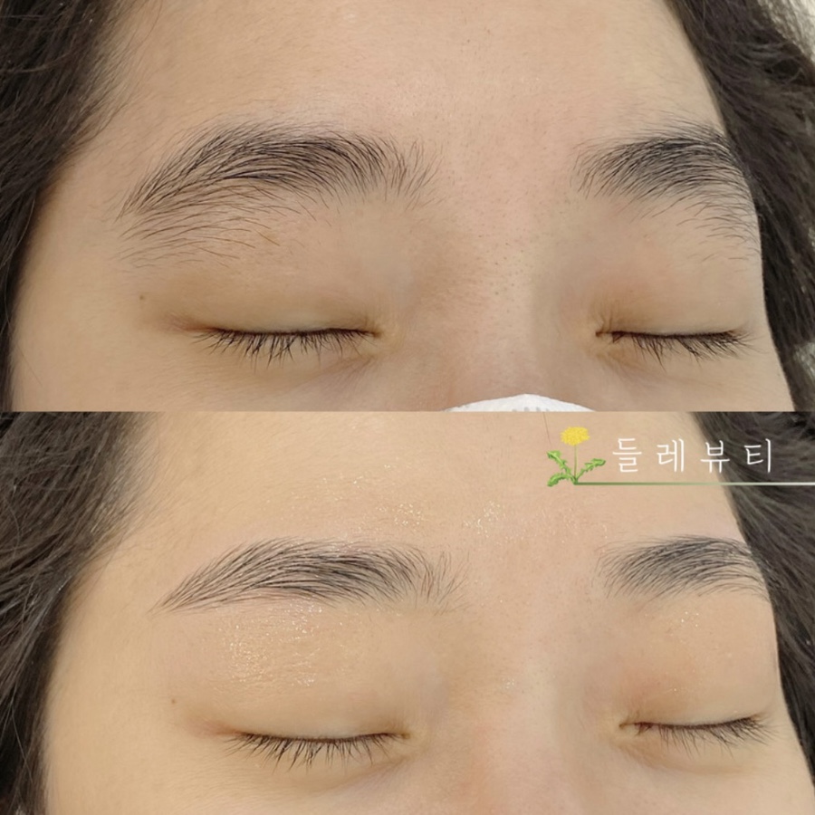 들레뷰티 이미지