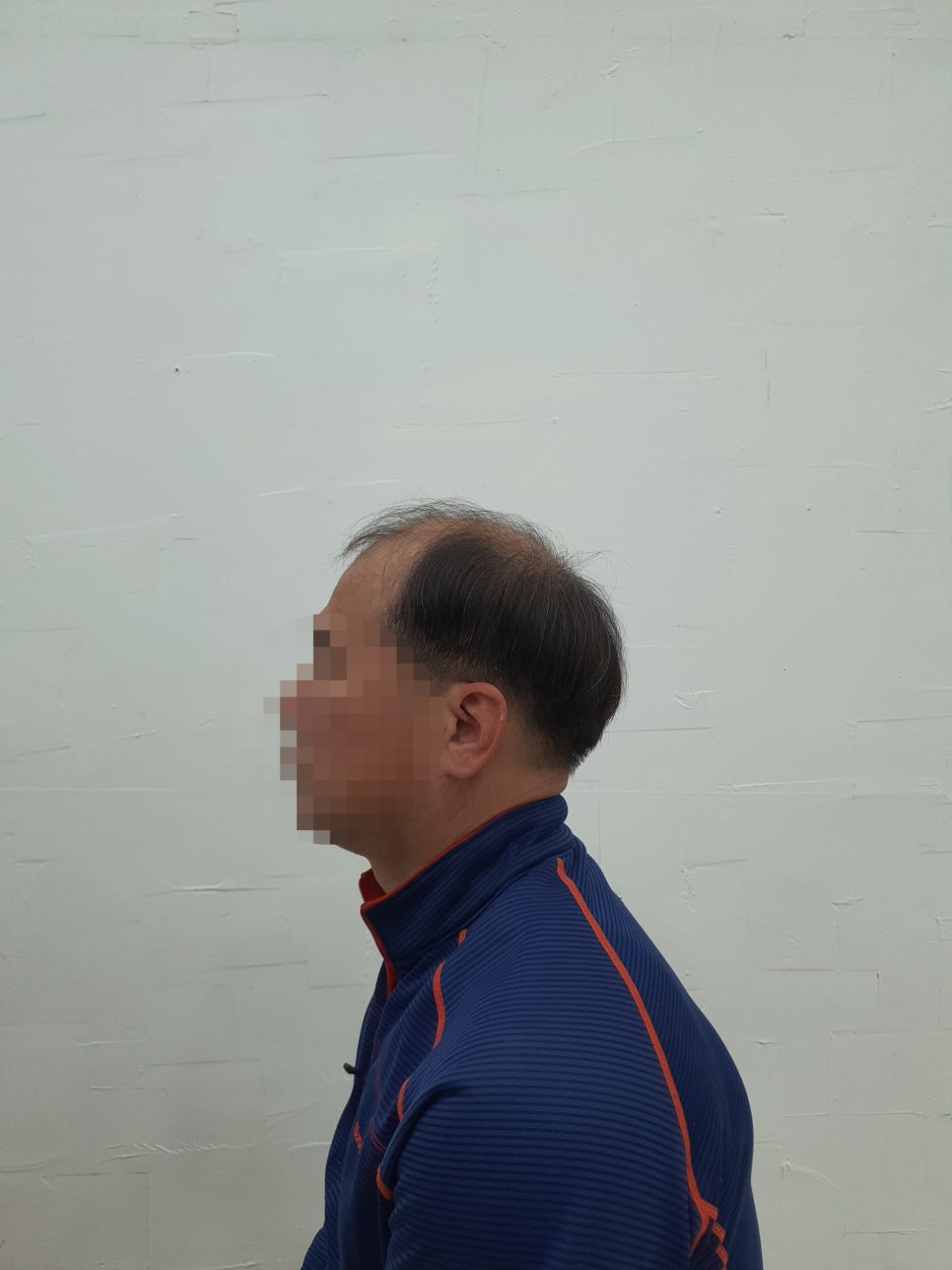 전주동안가발 이미지