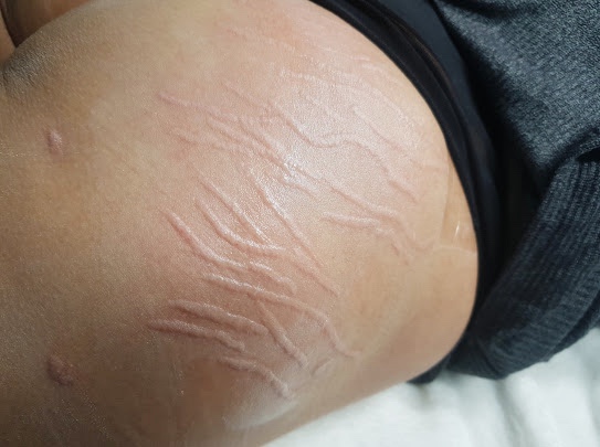 스칼프디자인센터 이미지