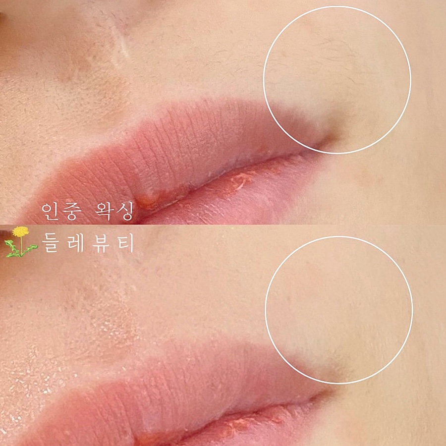 들레뷰티 이미지