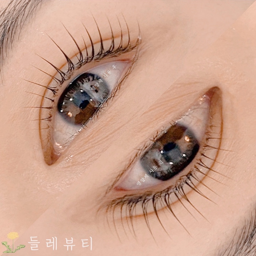 들레뷰티 이미지