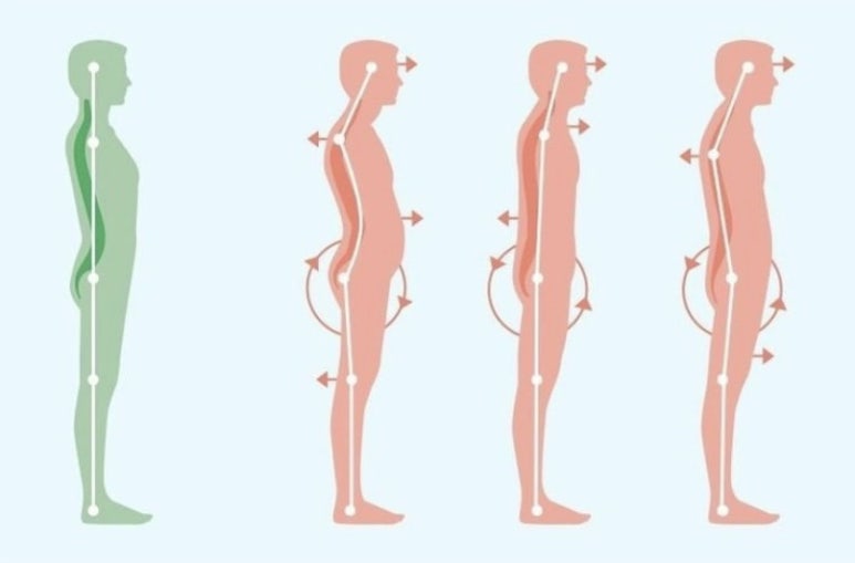 플럼라인 이미지