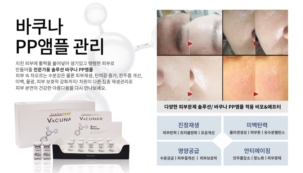 피피(PP) 이미지