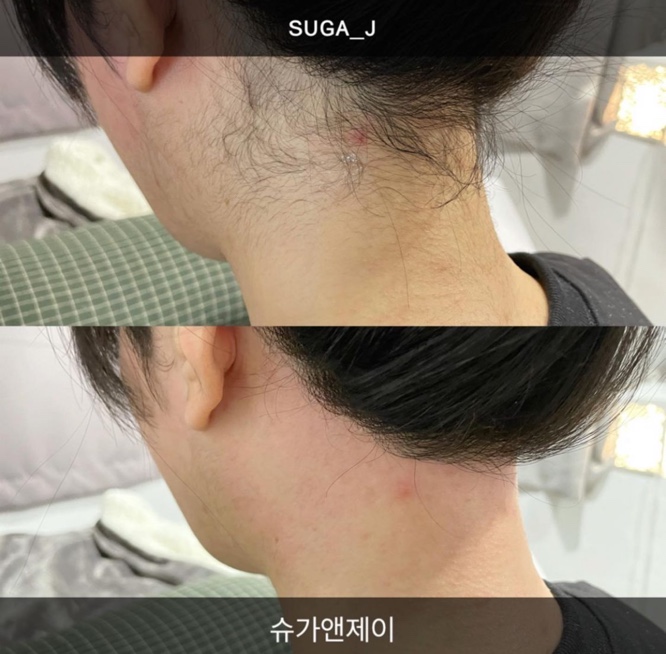 슈가앤라인 이미지