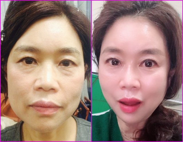셀비아 이미지