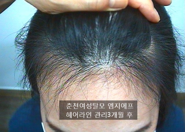 헤어,어느날 이미지