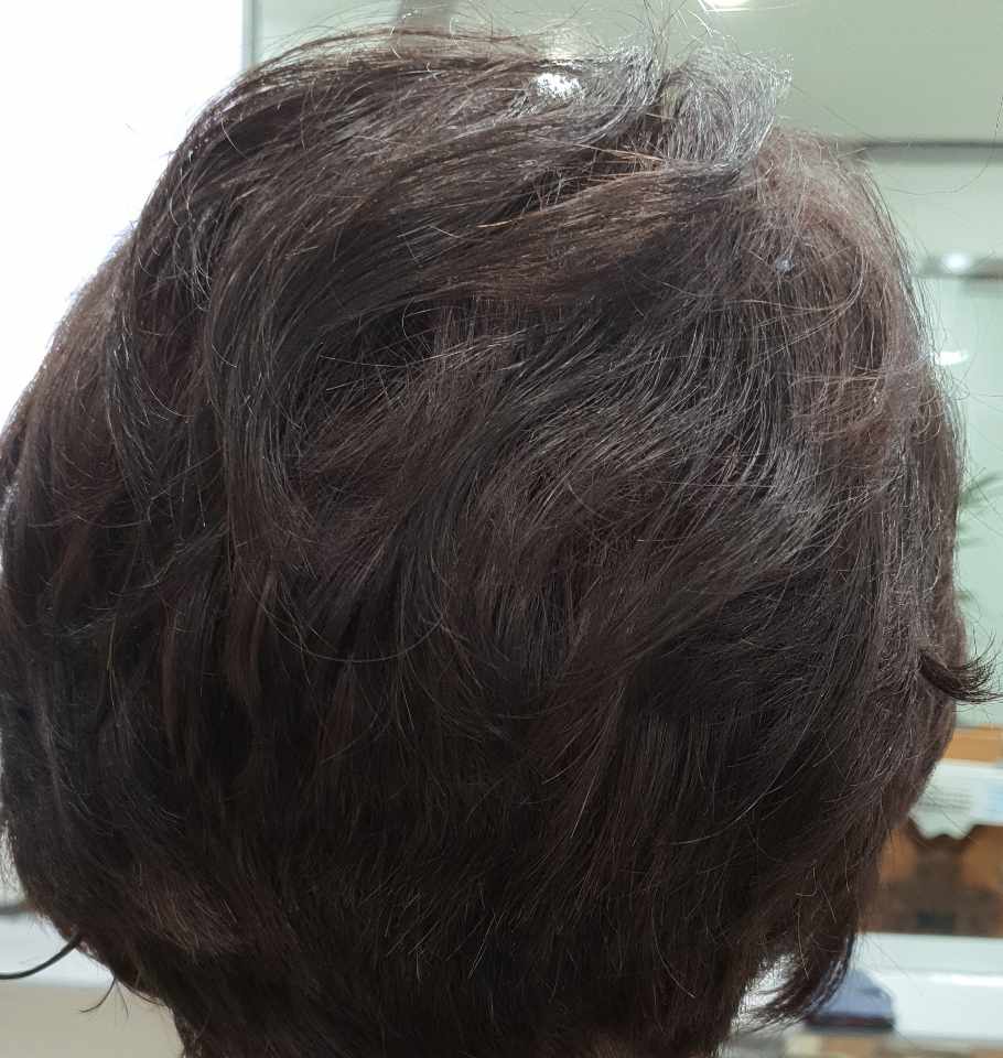 전주동안가발 이미지