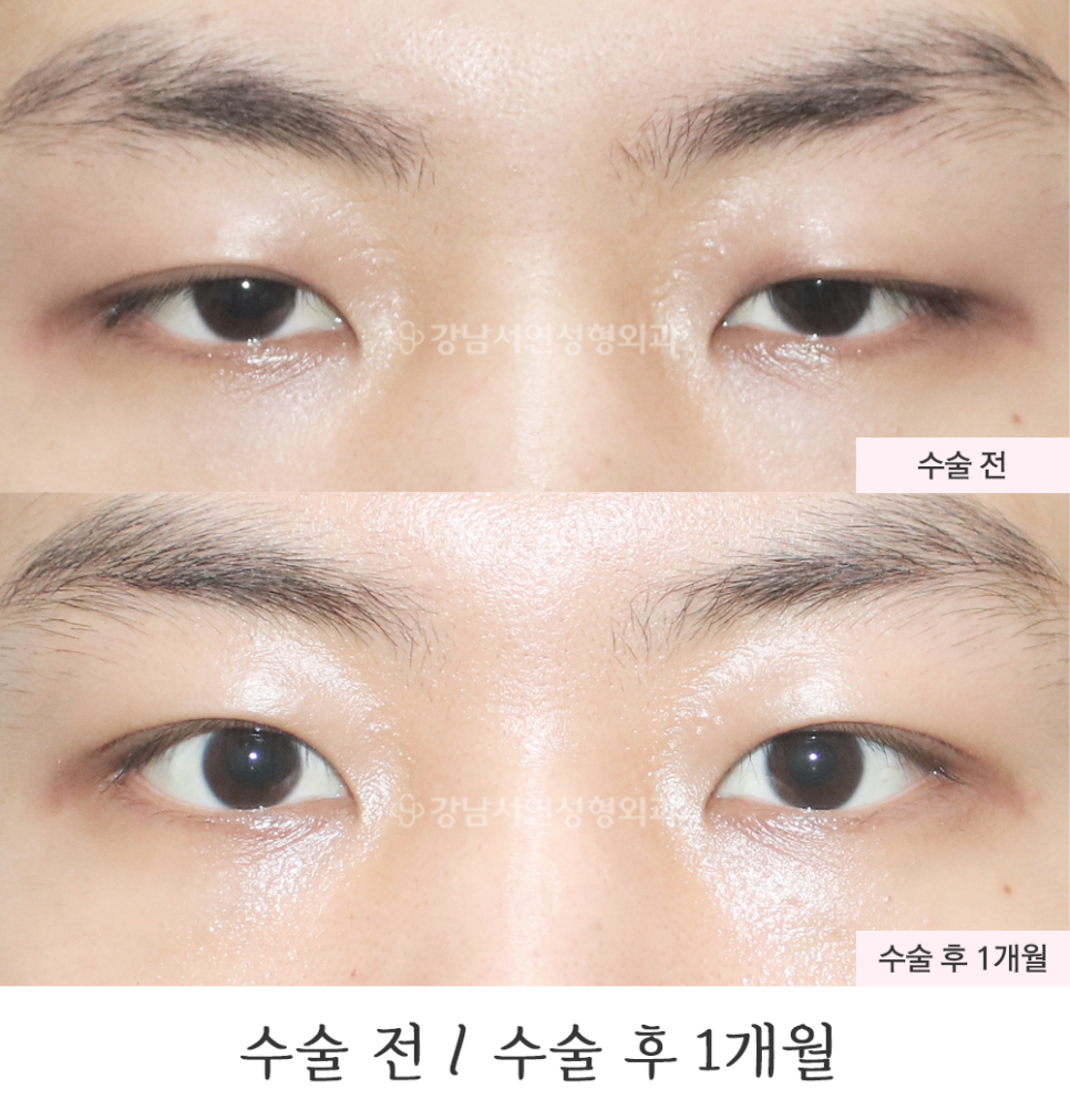 서연성형외과의원 이미지