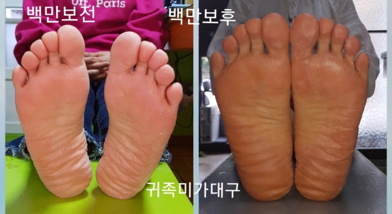 귀족미가 이미지