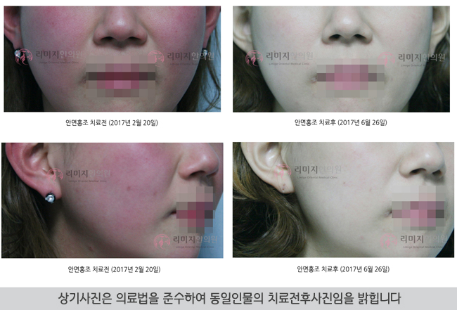 달아오름 이미지