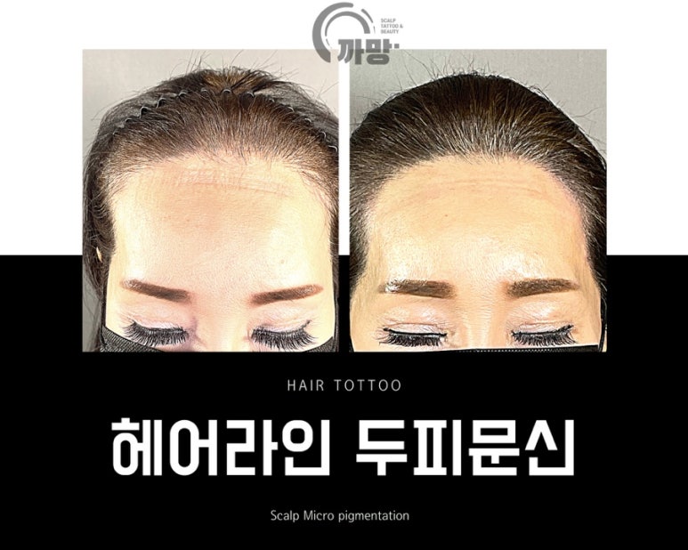 까망라인 이미지