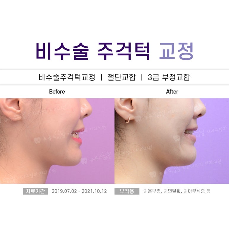 서면뉴욕치과의원 이미지