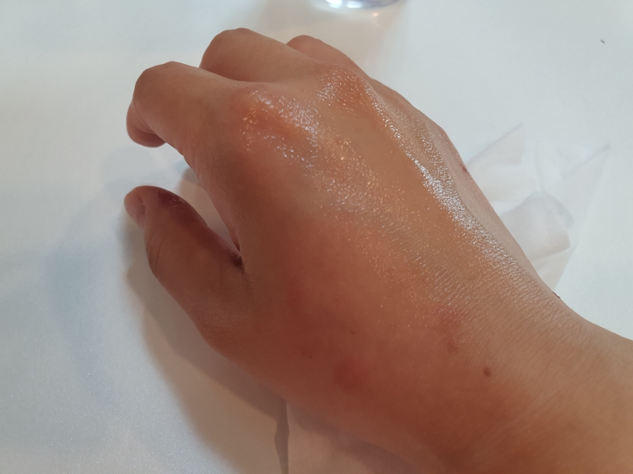 오마이클린 이미지