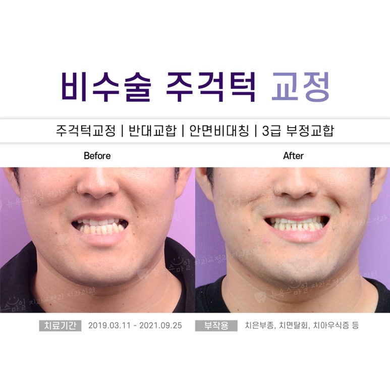 서면뉴욕치과의원 이미지