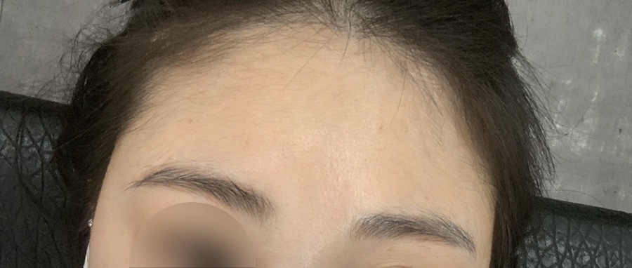 권헤어라인 이미지