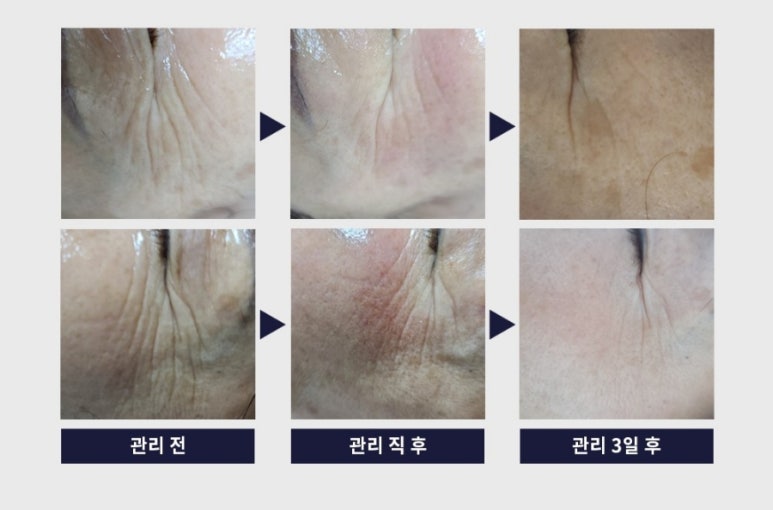 피부빛나다 이미지