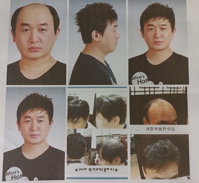 에이모가발 이미지