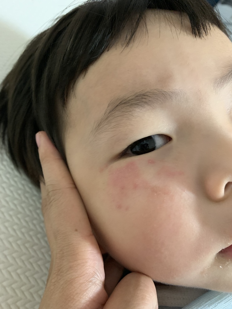 덕천필피부과 이미지