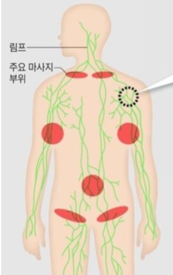 경혈테라피 이미지