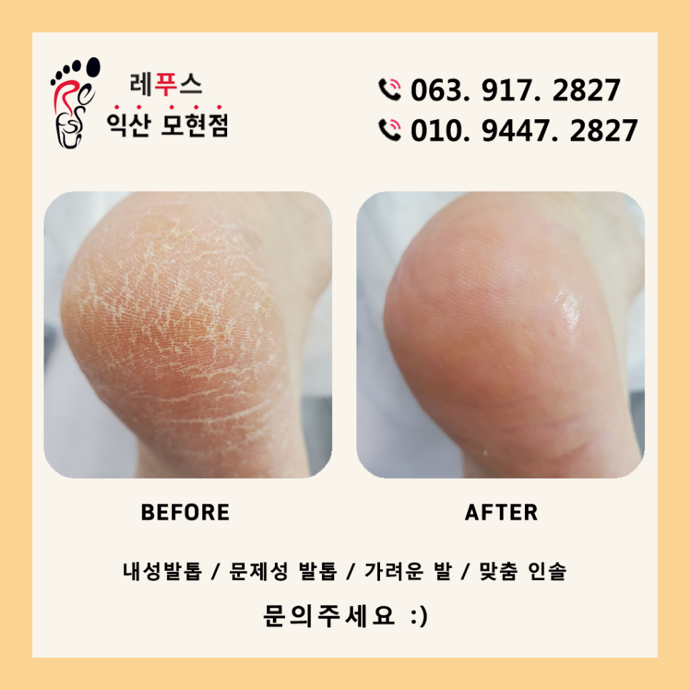 레푸스익산 이미지