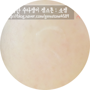 비타민마사지 이미지