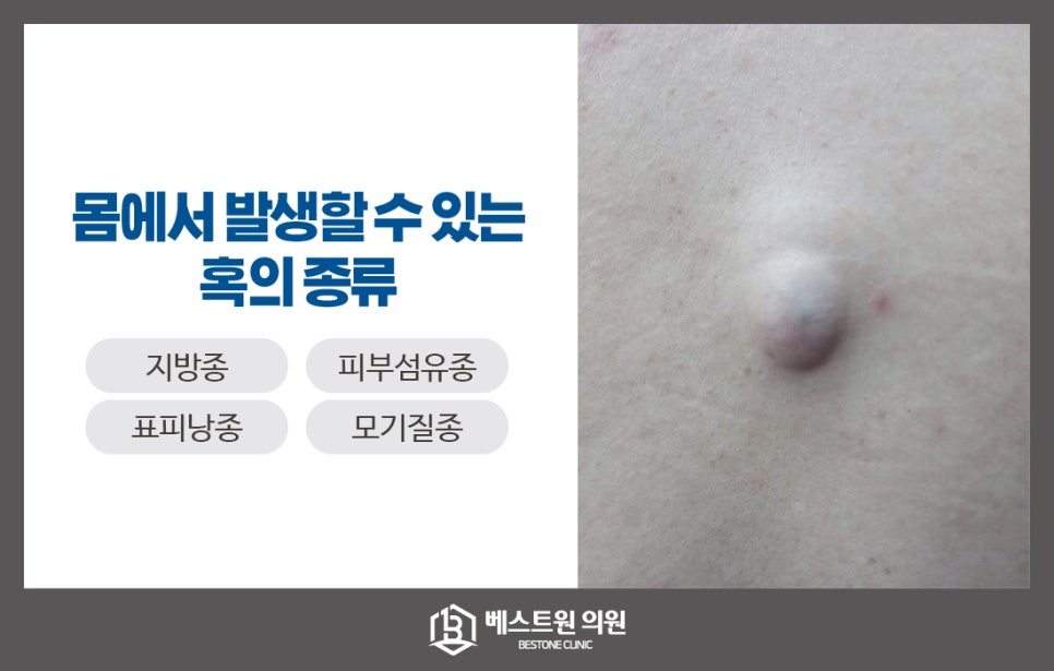 베스트원의원 이미지