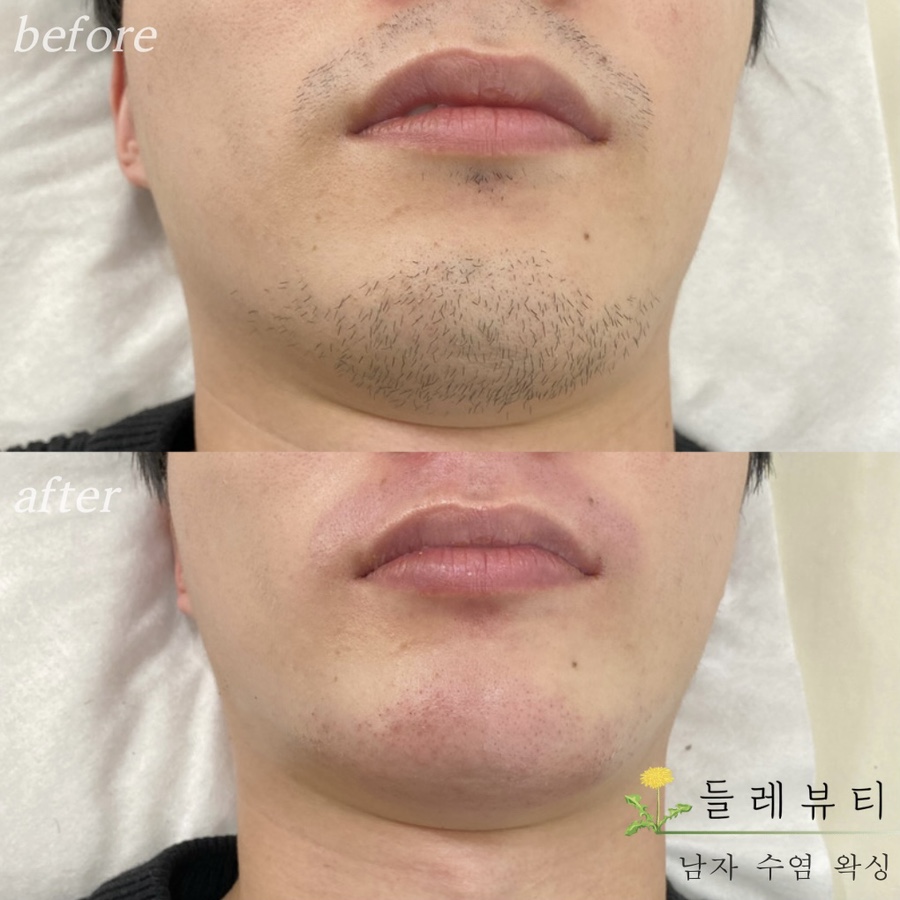 들레뷰티 이미지