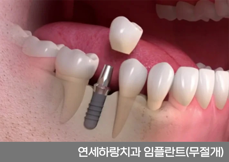 연세하랑치과의원 이미지
