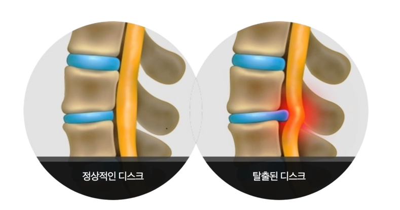 더디스크 이미지