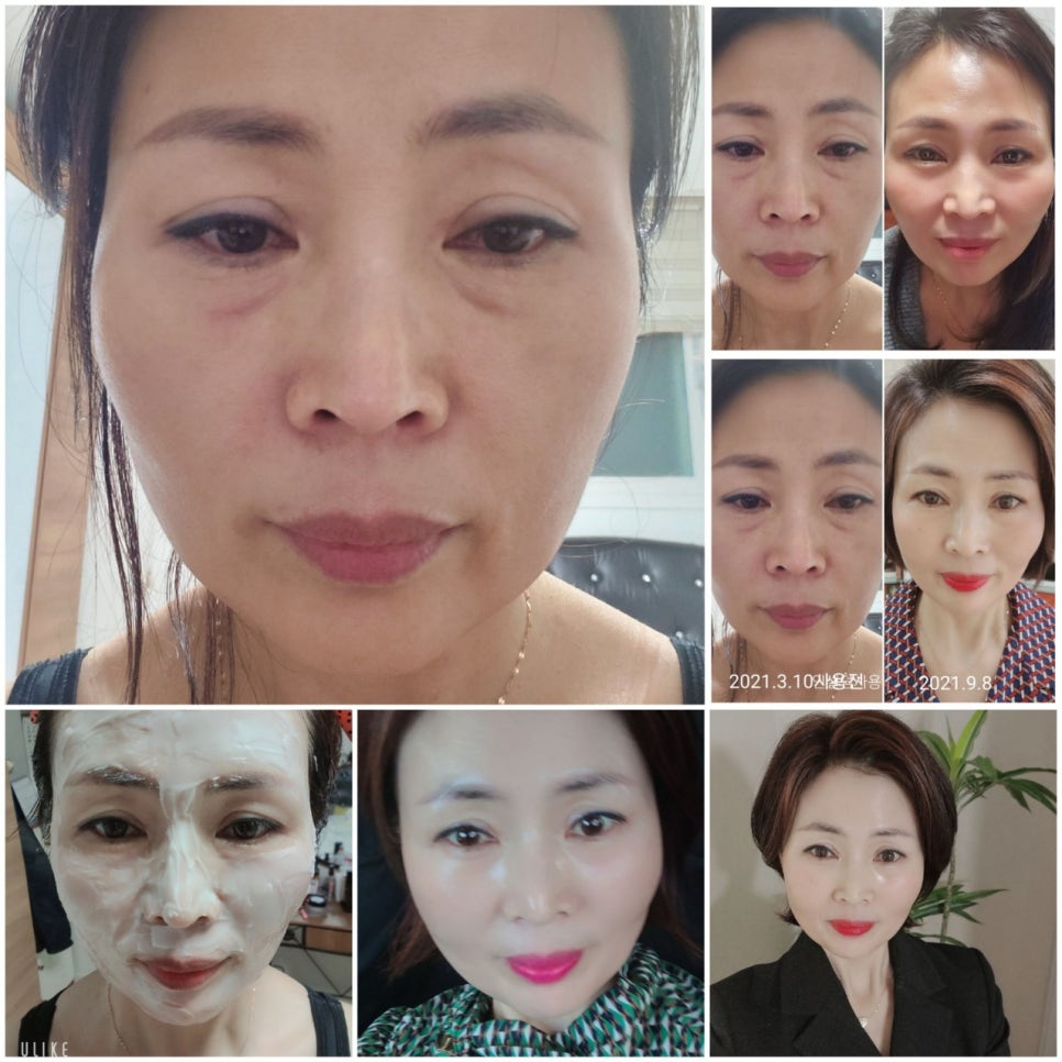 인셀덤237대리점 이미지
