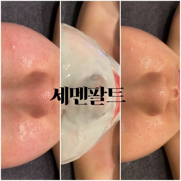 정피부 이미지