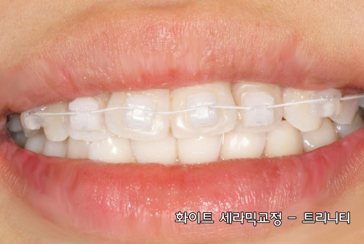 연세하랑치과의원 이미지