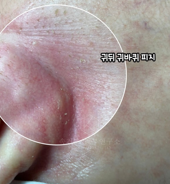 피지케이 이미지