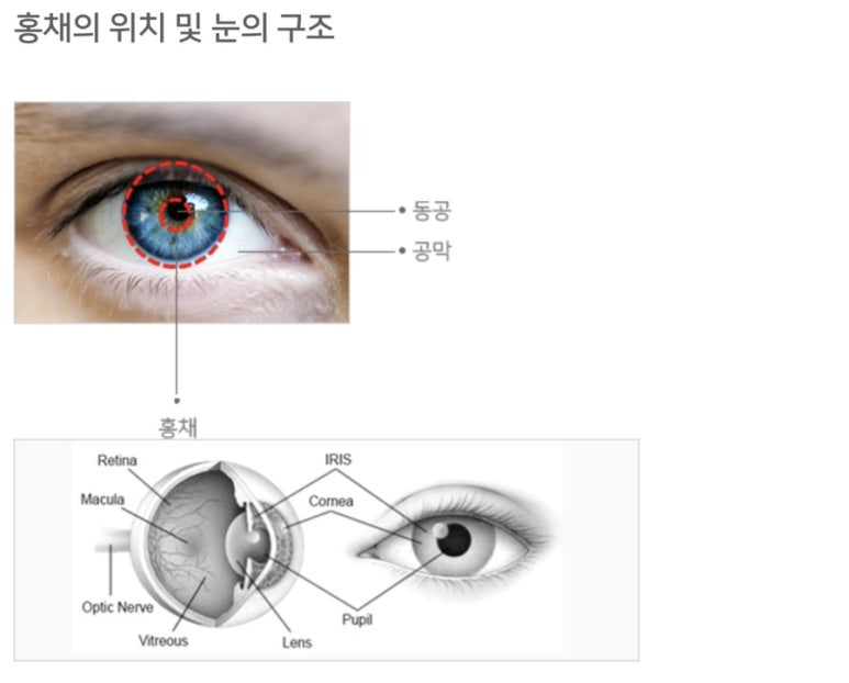 법인홍채 이미지