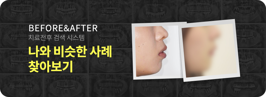 수지좋은치과의원 이미지